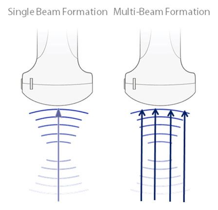 Single Beam vs 4 Multi Beam Formation